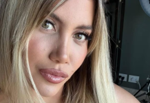 El abogado de Wanda Nara hablo sobre la cirugía que tuvo la mediática en pleno conflicto con Icardi