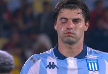 Sosa sufrió una fractura en la cara tras el golpe involuntario de Rojo en la semifinal con Flamengo