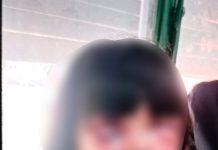 Un hombre le desfiguró la cara a golpes a una nena de 7 años, atacó a la madre y fue detenido por vecinos en Gerli