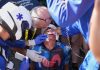 Escandaloso accidente en el Tour de France: un ciclista chocó contra un auto que frenó de golpe, recibió 20 puntos en el rostro y abandonó la carrera