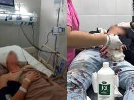 Denunciaron una brutal golpiza por homofobia contra una pareja en Tucumán: uno de ellos está en terapia intensiva