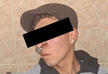 La Matanza: se peleó por el amor de una mujer y le clavaron una llave en la cara